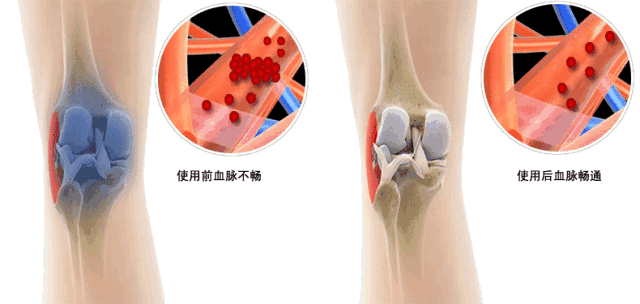 黑科技石墨烯发热磁护膝，1分钟暖到骨头里(图7)