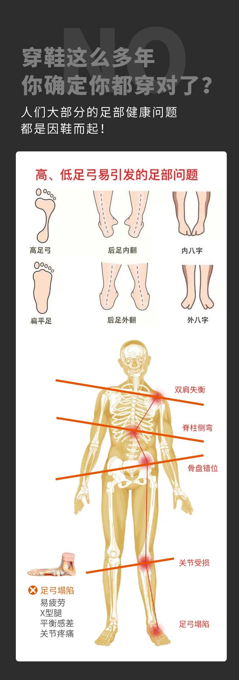 达圆邦磁力鞋(图1)